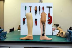 🦿 Medical Import Demand from Yemen – Prosthetic Materials and Assistive Devices